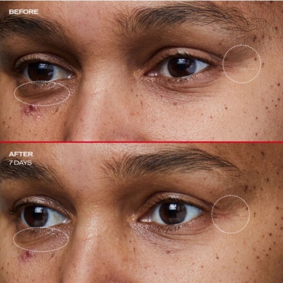 SET—Shiseido Benefiance Wrinkle Smoothing Eye Cream+Complete Cleansing Microfoam - Picture 12 of 15